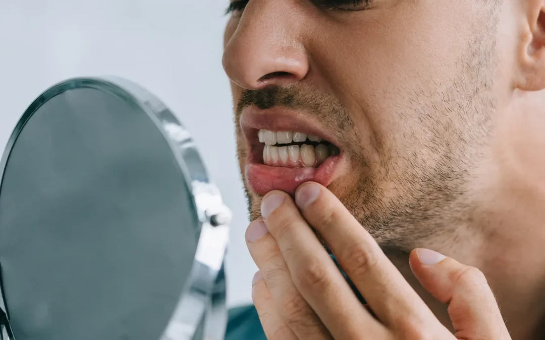 Parodontite: cos’è, come si riconosce e cosa fare prima che sia tardi