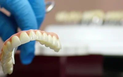 Full Arch su impianti: la soluzione definitiva per chi ha perso tutti i denti