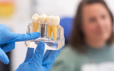 Impianti dentali e parodontite: si possono fare? Rischi, condizioni e percorso corretto
